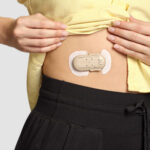 CeQur Simplicity Wearable Mealtime Insulin Patch